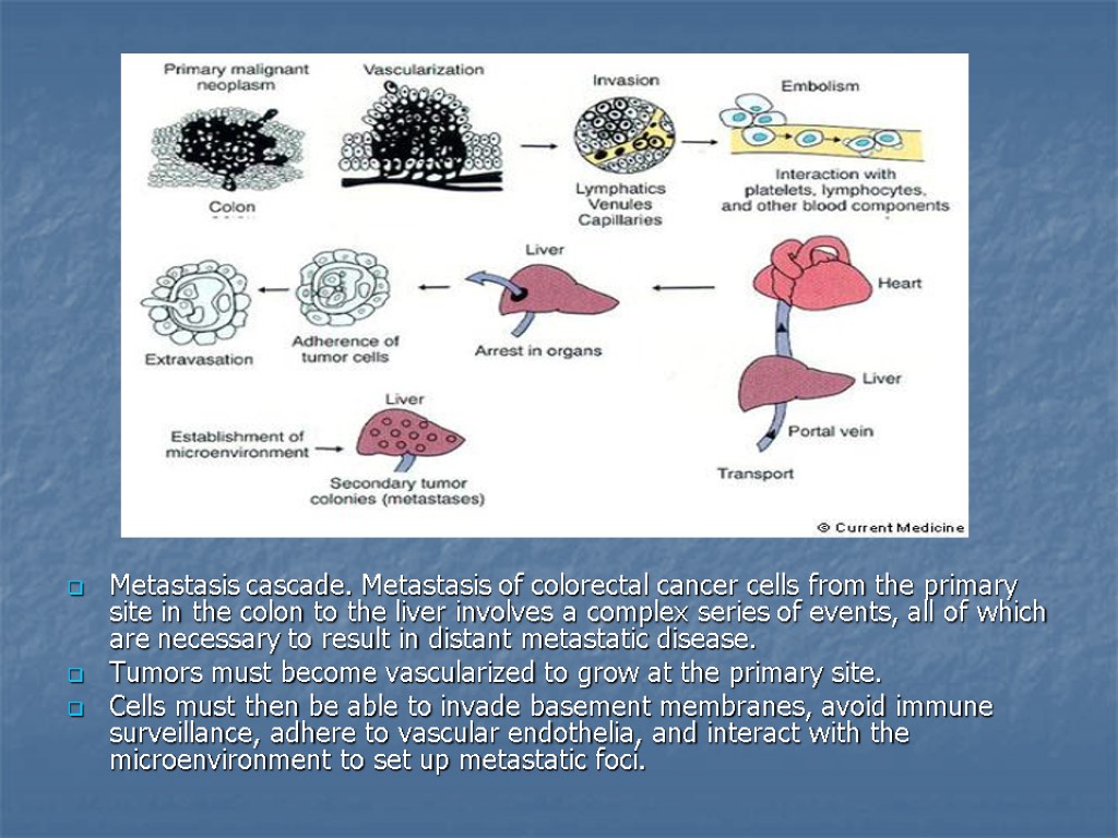 Metastasis cascade. Metastasis of colorectal cancer cells from the primary site in the colon